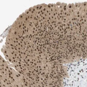 Merck Anti-ARID1B antibody produced in rabbit