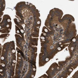 Merck Anti-KIAA0430 antibody produced in rabbit