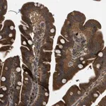 Merck Anti-KIAA0430 antibody produced in rabbit