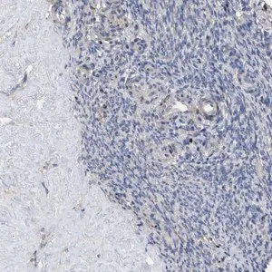 Merck Anti-HTR1A antibody produced in rabbit