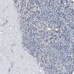 Merck Anti-HTR1A antibody produced in rabbit