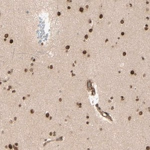 Merck Anti-ZMYM6 antibody produced in rabbit