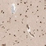 Merck Anti-ZMYM6 antibody produced in rabbit