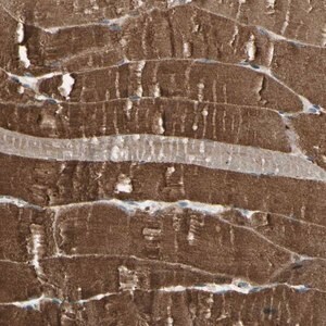 Merck Anti-P3H2 antibody produced in rabbit