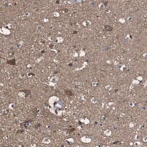 Merck Anti-PTPRR antibody produced in rabbit