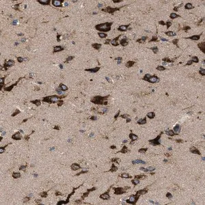 Merck Anti-IL1RL2 antibody produced in rabbit