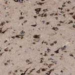 Merck Anti-IL1RL2 antibody produced in rabbit