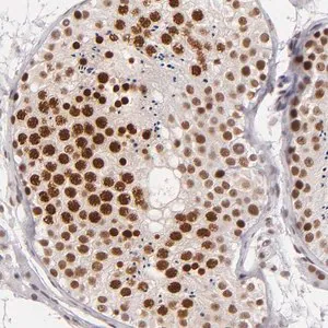 Merck Anti-BRD8 antibody produced in rabbit