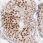 Merck Anti-BRD8 antibody produced in rabbit