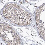 Merck Anti-MMEL1 antibody produced in rabbit