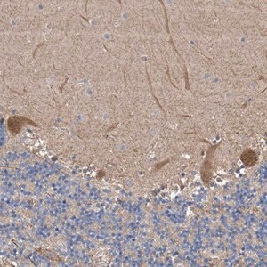 Merck Anti-PTK2 antibody produced in rabbit