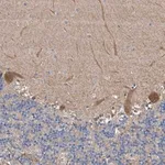 Merck Anti-PTK2 antibody produced in rabbit