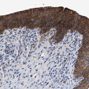 Merck Anti-ZDHHC24 antibody produced in rabbit