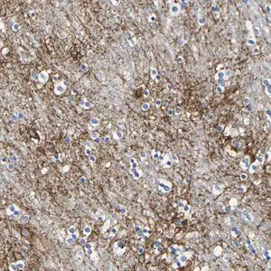 Merck Anti-OTOF antibody produced in rabbit