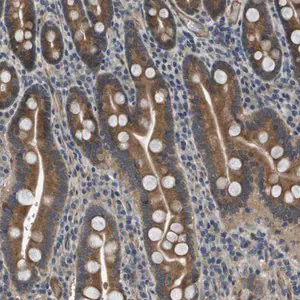 Merck Anti-PGAP3 antibody produced in rabbit