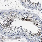 Merck Anti-LRRC37B antibody produced in rabbit