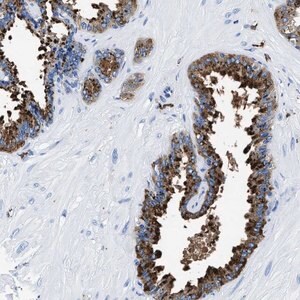 Merck Anti-OR14K1 antibody produced in rabbit