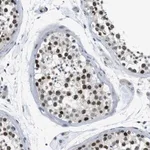 Merck Anti-SMCO2 antibody produced in rabbit