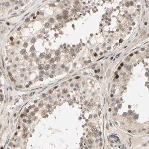 Merck Anti-SVBP antibody produced in rabbit