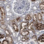 Merck Anti-ADCY10 antibody produced in rabbit