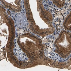 Merck Anti-PIGL antibody produced in rabbit