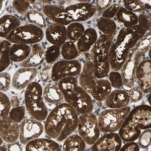 Merck Anti-KLHL8 antibody produced in rabbit