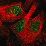 Merck Anti-CBARP antibody produced in rabbit