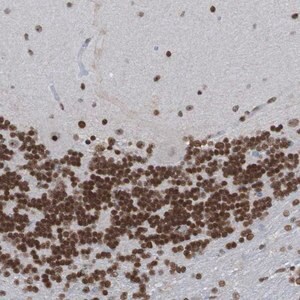 Merck Anti-PHF2 antibody produced in rabbit