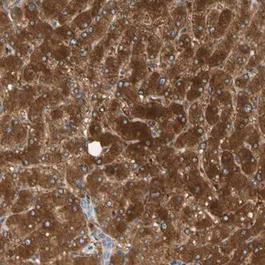 Merck Anti-PARP14 antibody produced in rabbit