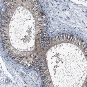 Merck Anti-LRIG2 antibody produced in rabbit