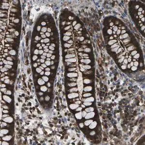 Merck Anti-CDH23 antibody produced in rabbit