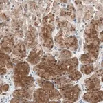 Merck Anti-GART antibody produced in rabbit
