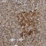 Merck Anti-HECW1 antibody produced in rabbit