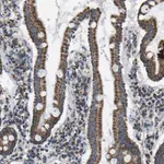 Merck Anti-IRX6 antibody produced in rabbit