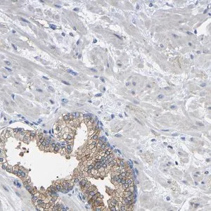 Merck Anti-CMTM1 antibody produced in rabbit
