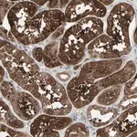 Merck Anti-IGFBP6 antibody produced in rabbit