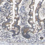 Merck Anti-INTS6L antibody produced in rabbit