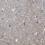 Merck Anti-HK1 antibody produced in rabbit