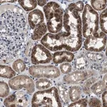 Merck Anti-GLIPR1 antibody produced in rabbit