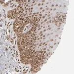 Merck Anti-MLLT6 antibody produced in rabbit