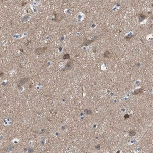 Merck Anti-PIP5K1C antibody produced in rabbit