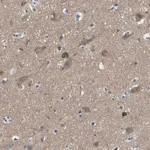 Merck Anti-PIP5K1C antibody produced in rabbit