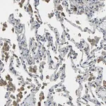 Merck Anti-PLCE1 antibody produced in rabbit