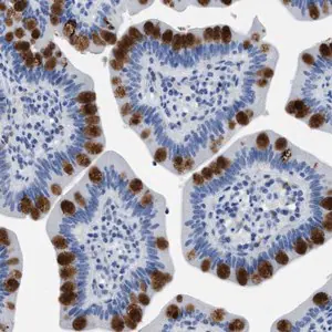 Merck Anti-HABP2 antibody produced in rabbit