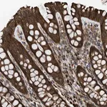 Merck Anti-SESN2 antibody produced in rabbit