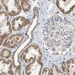 Merck Anti-HLCS antibody produced in rabbit