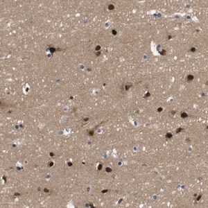 Merck Anti-ZBTB46 antibody produced in rabbit