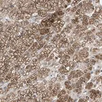 Merck Anti-GPAT4 antibody produced in rabbit