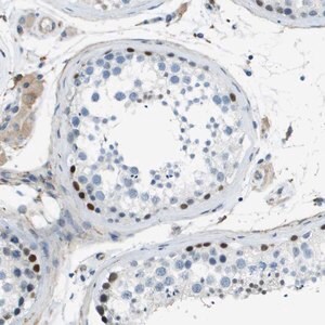 Merck Anti-ZBTB43 antibody produced in rabbit