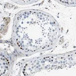 Merck Anti-ZBTB43 antibody produced in rabbit